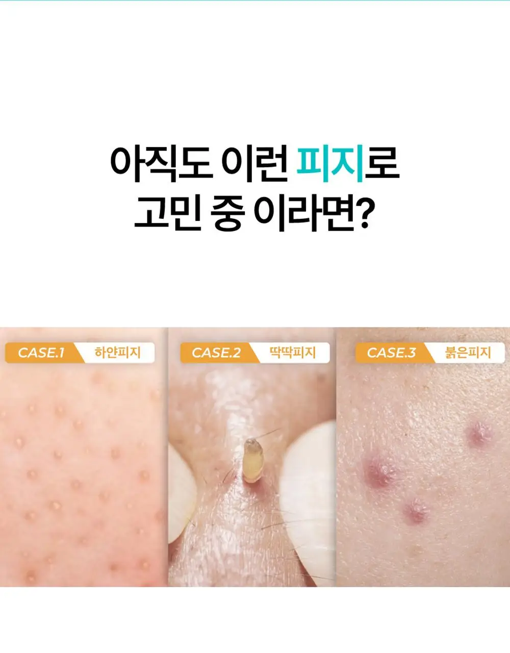 [수딩진정] 넘버즈인 1번 판토텐산 액티브 수딩크림 80ml 1+1 기획 상세페이지 6